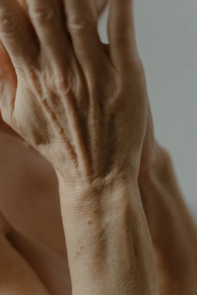 Image of arthritic hand emphasizes inflammation, joint pain, importance of symptom management, treatment.